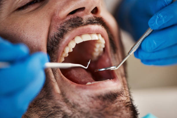 Best Mobile Emergency Dentist in Ina, IL