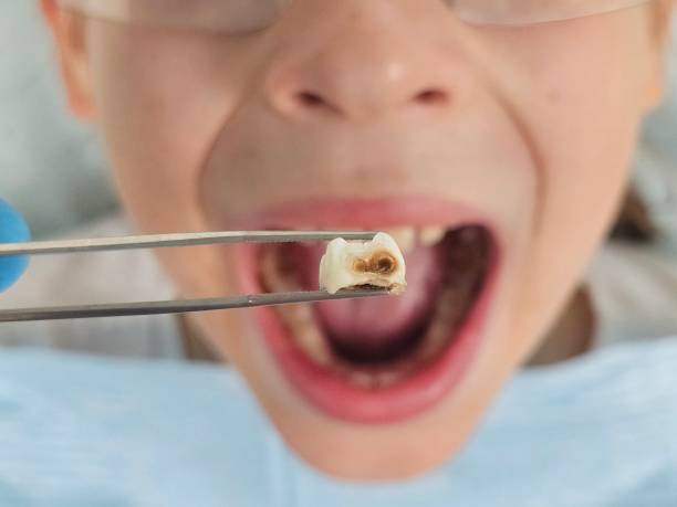Best Emergency Dental Care for Abscessed Tooth in Ina, IL